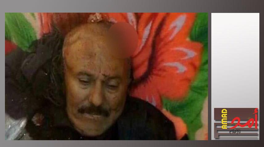 صور - قصة اغتيال الرئيس اليمني السابق علي عبد الله صالح..وتعرضه للخيانة