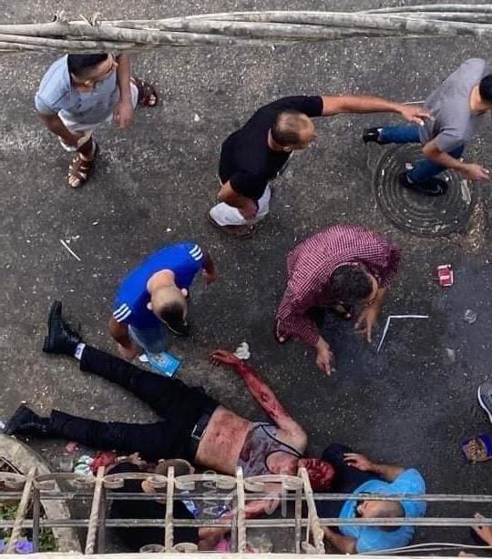 محدث - نابلس: وفاة مواطن وإصابة (7) آخرين بالرصاص خلال اشتباك مسلح في "بلاطة"