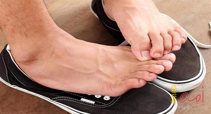 كيف تتخلص من رائحة القدمين الكريهة ؟