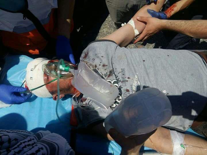 ثوري فتح ينعى شهيد الحرية والكرامة  البطل سبأ نضال عبيد ويحيي جماهير المقاومة الشعبية
