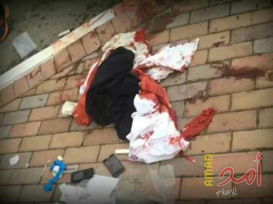مقتل الشرطي الإسرائيلي الذي أصيب في عملية الطعن بالقدس