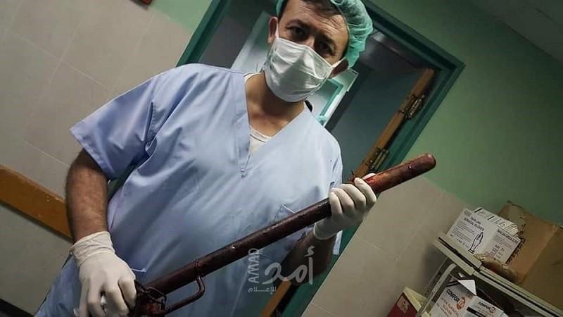 طبيب ماهر ينقذ شاب من الموت في غزة بعد تعرضه لحادث مخيف