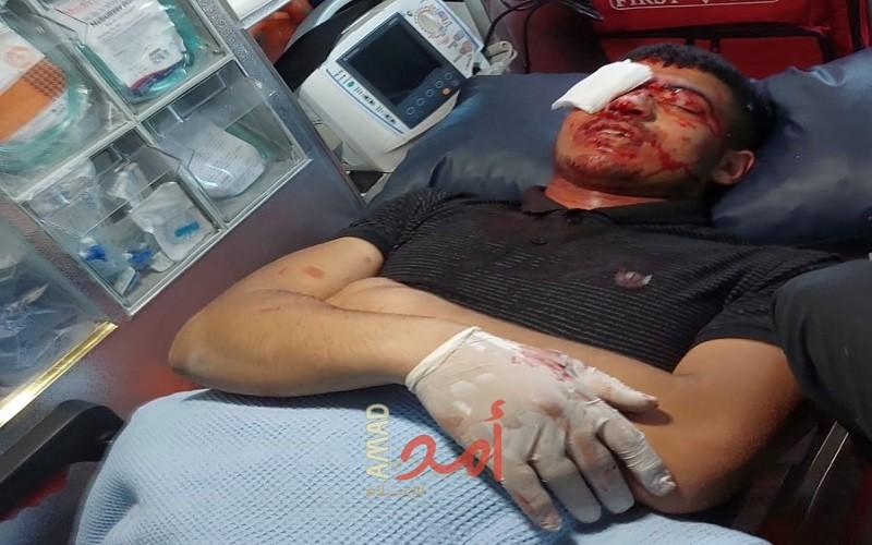 إصابات بالمطاط والاختناق خلال مواجهات مع قوات الاحتلال في قراوة بني حسان