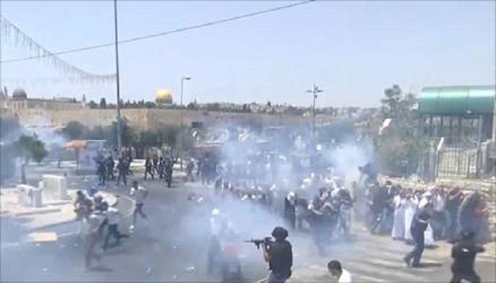 أصابة  11 شابا برصاص الاحتلال المعدني بينهم طفل في كفر قدوم