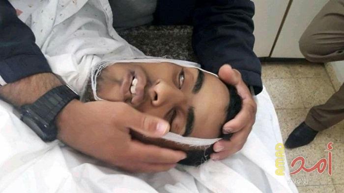 استشهاد المصاب "أحمد العاصي" متأثراً بجراحٍ أصيب بها شرق خانيونس