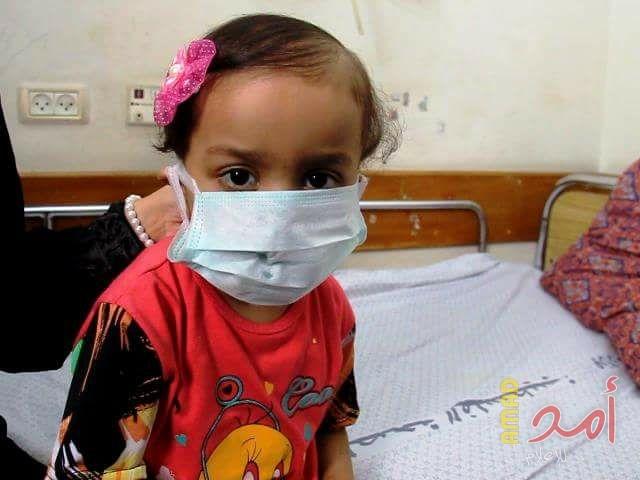 الصوص يثمن دور دائرة العلاج بالخارج في مساعدة مرضى السرطان