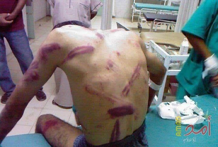 عُثر عليه بمخيم النصيرات.. حماس تعتدي بالضرب المبرح على المواطن "صلاح الطهراوي"