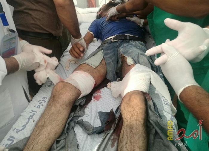 إصابة شاب بجراحٍ خطيرة بعد محاولته قص السياج الفاصل شرق غزة