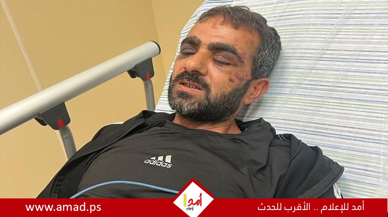 رام الله: المعتقل زهران يروي تفاصيل مروّعة عن اعتداء جنود الاحتلال عليه
