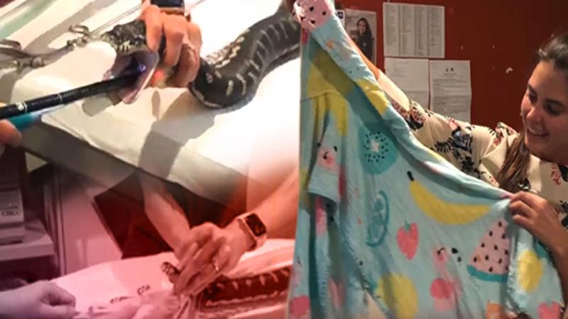 بالفيديو .. أطباء ينقذون "أفعى"بعد ابتلاعها منشفة شاطئ
