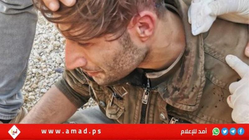 إصابة لبناني بـ"قنبلة دخانية" في رأسه خلال مواجهات مع الجيش الإسرائيلي- فيديو