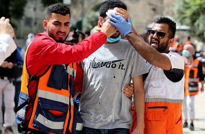 الهلال الأحمر: 520 إصابة خلال مواجهات الأقصى بينها حالات خطيرة