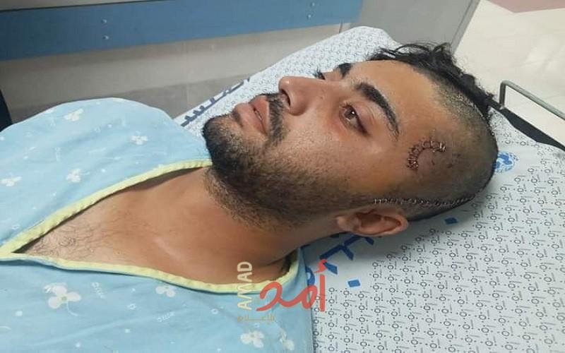 سلطات الاحتلال تفرج عن صياد مصاب من غزة