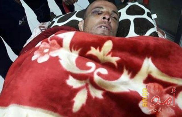 سلطات الاحتلال تفرج عن الصياد خضر الصعيدي بعد أن أفقدته عينه