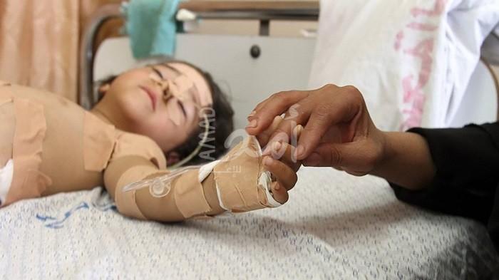 صحة حماس بغزة تحذر من كارثة تهدد الأطفال المرضى لنفاد الحليب العلاجي