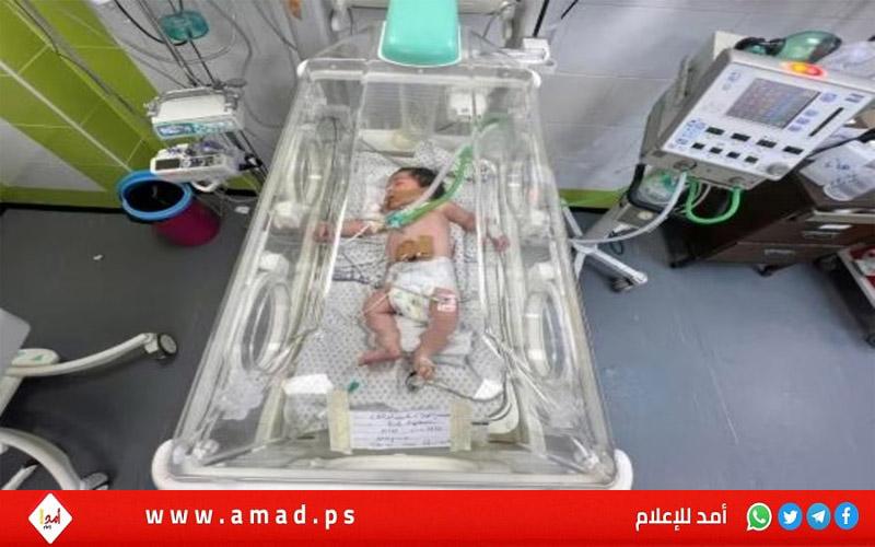 "الأونروا" تحذر من ولادات مبكرة ومضاعفات غير مألوفة للأطفال الخدج في قطاع غزة