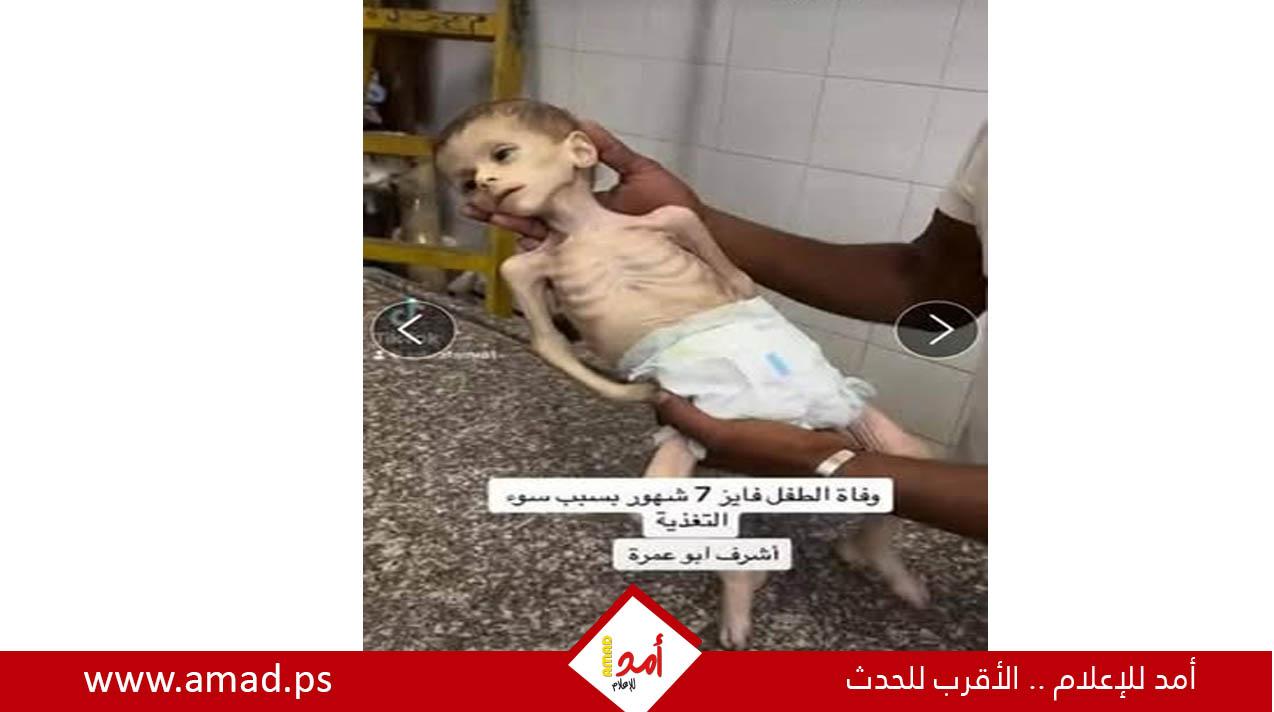الجوع ينهش أجساد الأهل في غزة