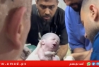 طبيب فلسطيني: وفاة "الطفلة المعجزة" بعد 4 أيام من ولادتها