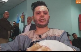 غزة: أحد مصابي حريق النصيرات يروي تفاصيل الإهمال من الطواقم الطبية