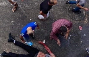 محدث - نابلس: وفاة مواطن وإصابة (7) آخرين بالرصاص خلال اشتباك مسلح في "بلاطة"