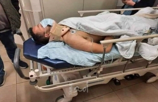 إصابة الشاب "أحمد الشيخ علي" بكسور بعد مطاردته والاعتداء عليه من قبل المستوطنين