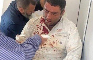 "محدث" مستوطنون إرهابيون يهاجمون "أهالي المغير" في رام الله ويصيبون مواطن بجراح- فيديو