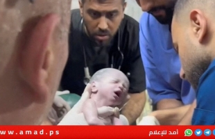 طبيب فلسطيني: وفاة "الطفلة المعجزة" بعد 4 أيام من ولادتها