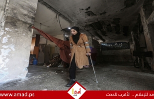 الصحة العالمية: أكثر من 5 آلاف فلسطيني خضعوا لبتر أطراف خلال حرب غزة