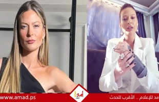 باميلا الكيك تروي معاناتها بعد كسر ذراعها الأيسر.. فيديو