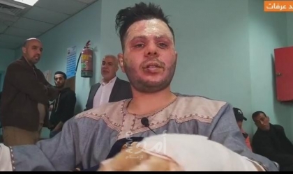 غزة: أحد مصابي حريق النصيرات يروي تفاصيل الإهمال من الطواقم الطبية
