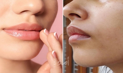 وصفات طبيعية لتفتيح منطقة الفم
