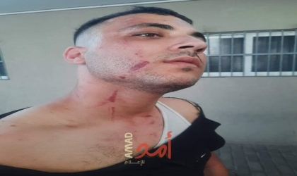 شرطة مرورو حماس تعتدي على المواطن عبد الكريم عجور  - صور