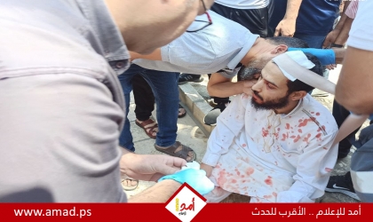إصابة شاب بجراح اثر سقوط شجرة في باحات "المسجد الأقصى"