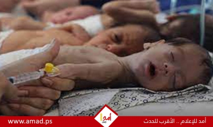 القدرة: فقدنا (27) طفل نتيجة سوء التغذية في شمال غزة ونطالب مؤسسات الطفولة بتوفير "الحليب"