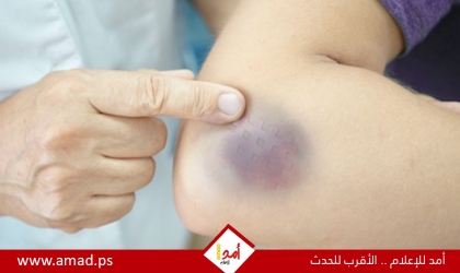 3 أسباب وراء الإصابة بالأورام الدموية
