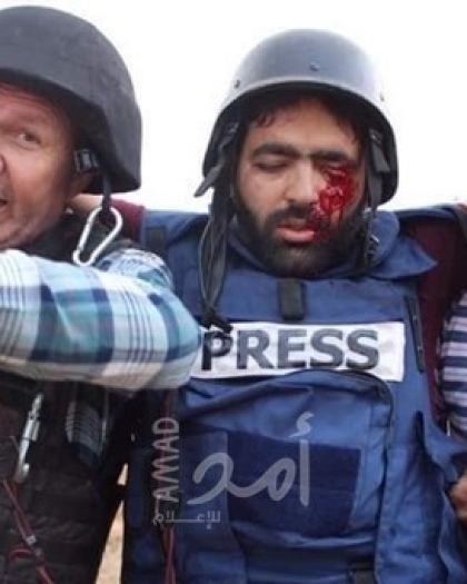 نقابة الصحفيين: عين "عمارنة" ساهمت بفتح عيون العالم على جرائم جيش الاحتلال بحق الصحفيين