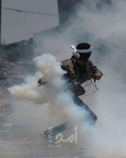 3 إصابات برصاص قوات الاحتلال خلال قمع مسيرة كفر قدوم الأسبوعية